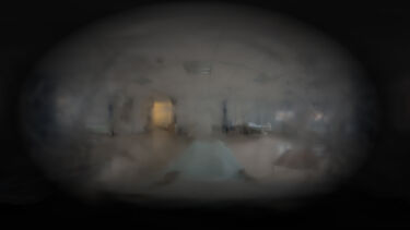 A blurred view of a hospital room, simulating the experience of living with glaucoma