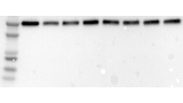 Western Blot