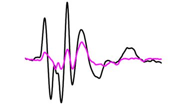 ABR waveforms