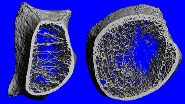 A CT scan of a bone against a blue background