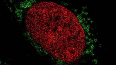 Dual colour STED image of chromatin in the nucleus