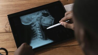 Tablet showing medical scan of a person's skull in profile.