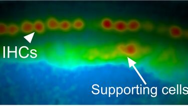 Spinning disk image hotspots