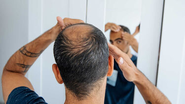 A balding man checking his hair loss in the mirror