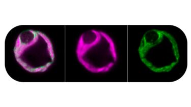 Plant cells under the microscope