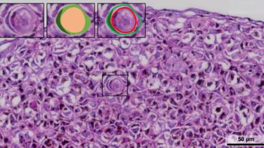 Cell Cannibalism