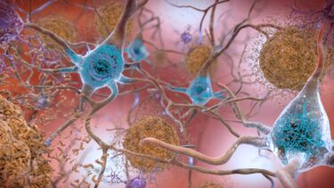 a network of neurons