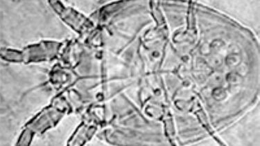 An adult Drosophila mite under a microscope