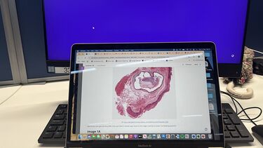 Image of a laptop in a library