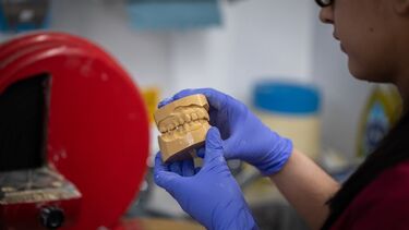 A person holding a mould of teeth.