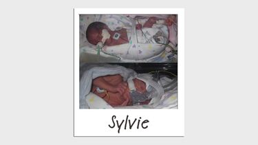 Two newborn babies with breathing tubes in the hospital