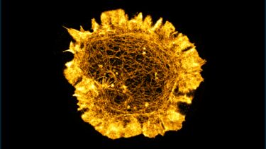 Image of an immune cell