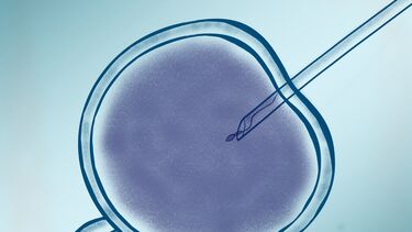 A visualisation of In vitro fertilization and assisted reproductive technology