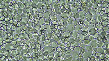 Image of Chickpea (Cicer arietinum) seed starch