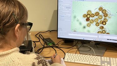 Image of a researcher photographing pollen grains