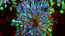 Stem cells