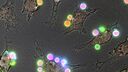 A microscopic view of a fungus.