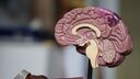 A plastic model of the brain anatomy