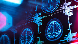 A photograph of different brain scans. 