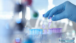 A eppendorf containing a sample used in analytical chemistry and DNA extraction awaiting testing in a laboratory - stock photo