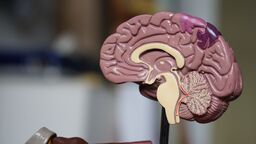 Accelerating Motor Neuron Disease Clinical Trials at the University of Sheffield, UK