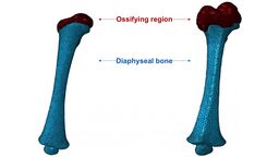Diagram showing Finite Element models of infant femur