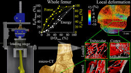 Graphical abstract - Damage tolerance and toughness of elderly human femora