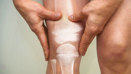 A person holding their knee in pain