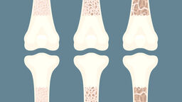 iHuman Bone Marrow