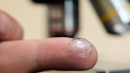 Contact lens