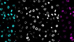 Typhoid Fever cells
