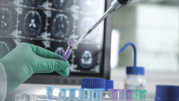Conceptual image of clinical research
