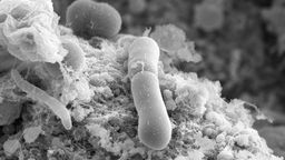 Scanning Electron Microscopy image of C. difficile in the gut of an infected animal 