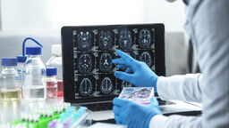 brain scan