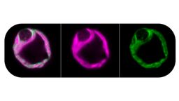 Plant cells under the microscope