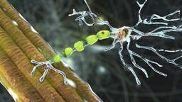 University of Sheffield Advances Motor Neuron Disease Clinical Trial Targeting UNC13A Protein