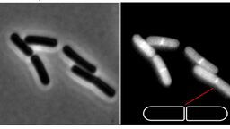 Image of a bacteria under a microscope 