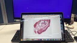 Image of a laptop in a library