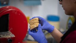 A person holding a mould of teeth.