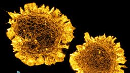 An image of an immune cell