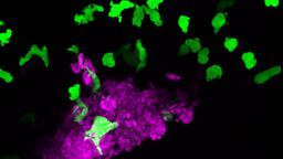 Investigating Antifungal Resistance: How the University of Sheffield Analyzes Candida albicans Immune Evasion