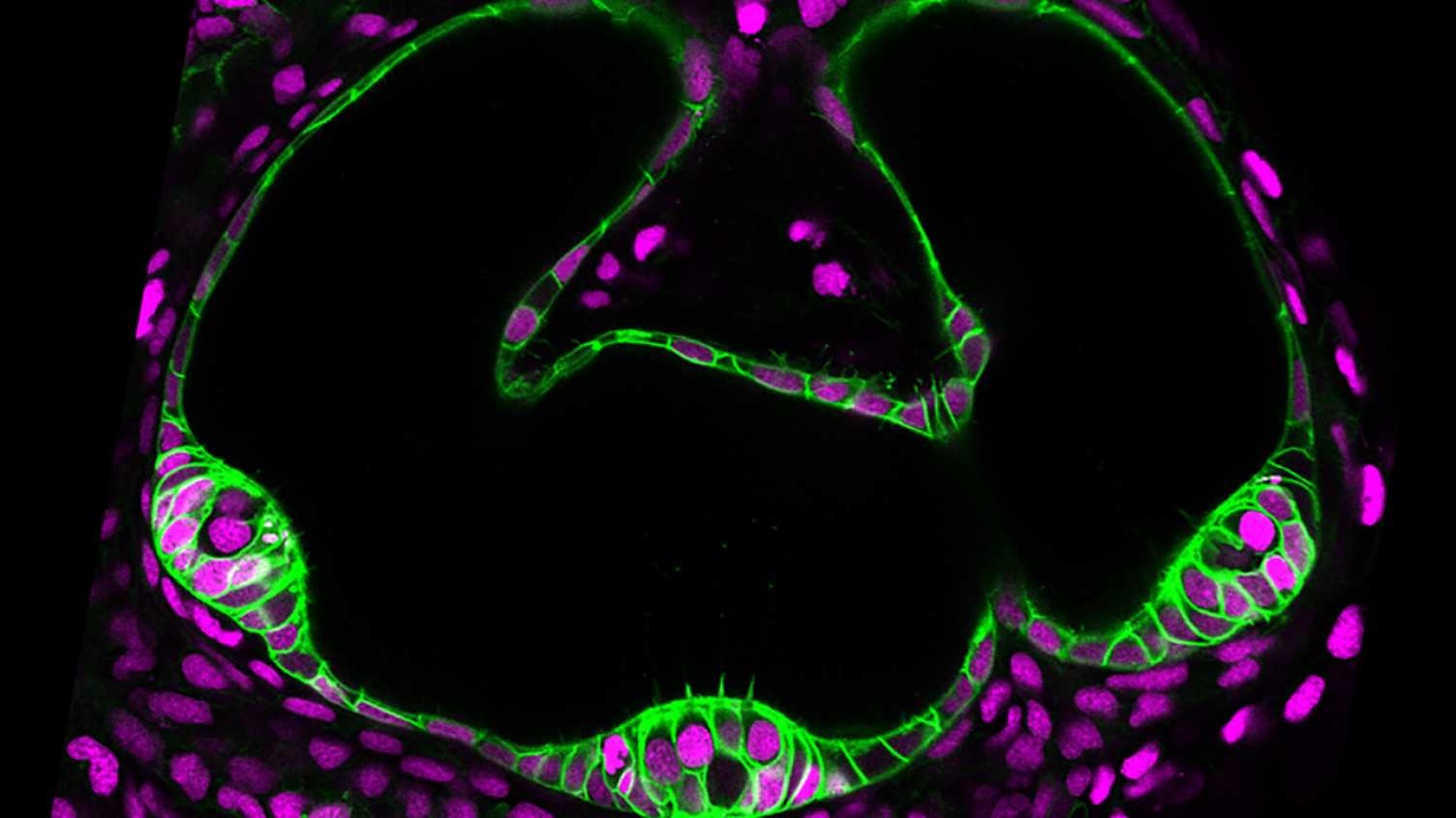 Thumbnail for Development of the inner ear | Hearing and Balance 
