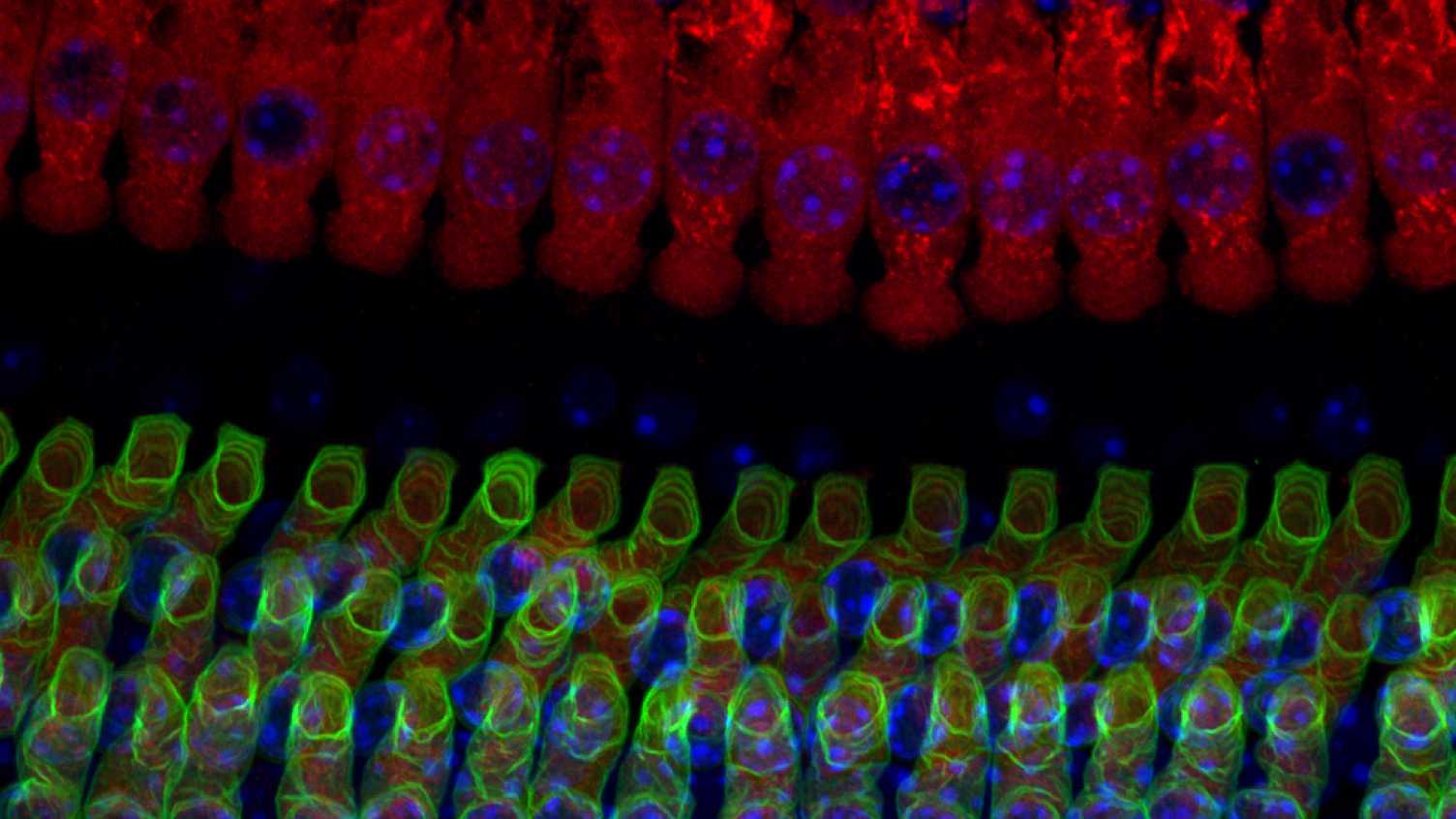 Thumbnail for Scientists awarded funding to investigate causes of age-related hearing loss | N…
