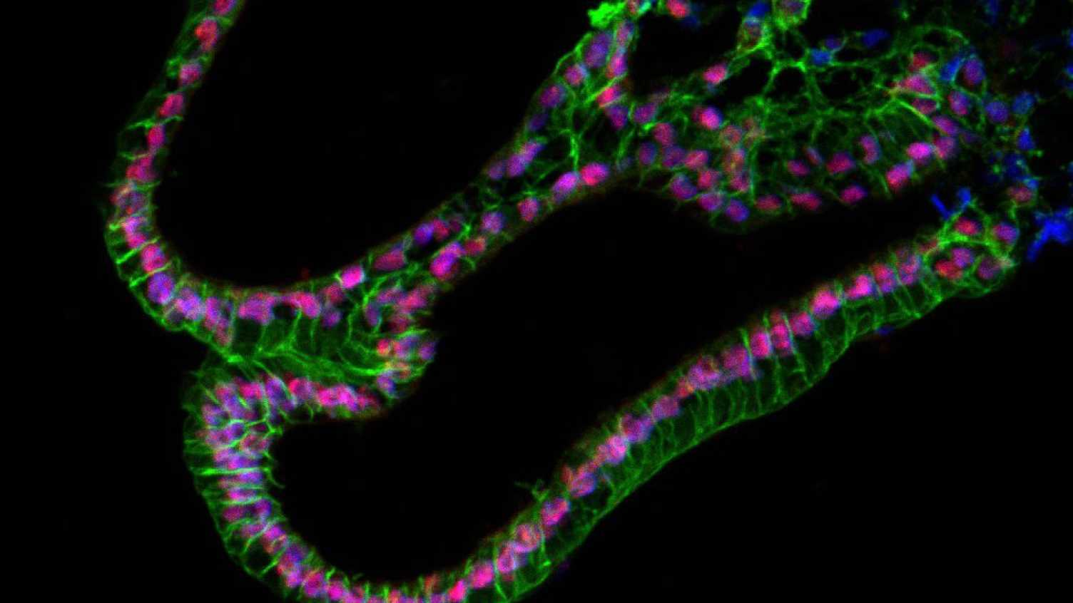 Thumbnail for Sensory stem cell biology and regeneration | Hearing and Balance 