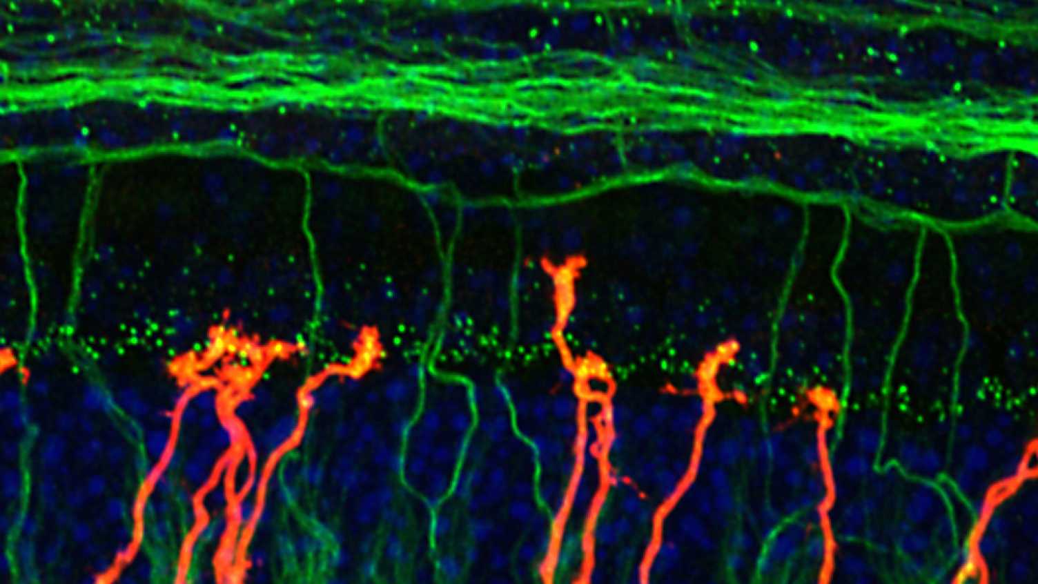 Thumbnail for Molecular genetics | Hearing and Balance 