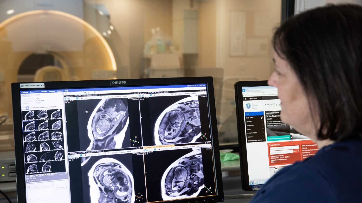Thumbnail for Planning a New MRI Study | Medicine and Population Health 