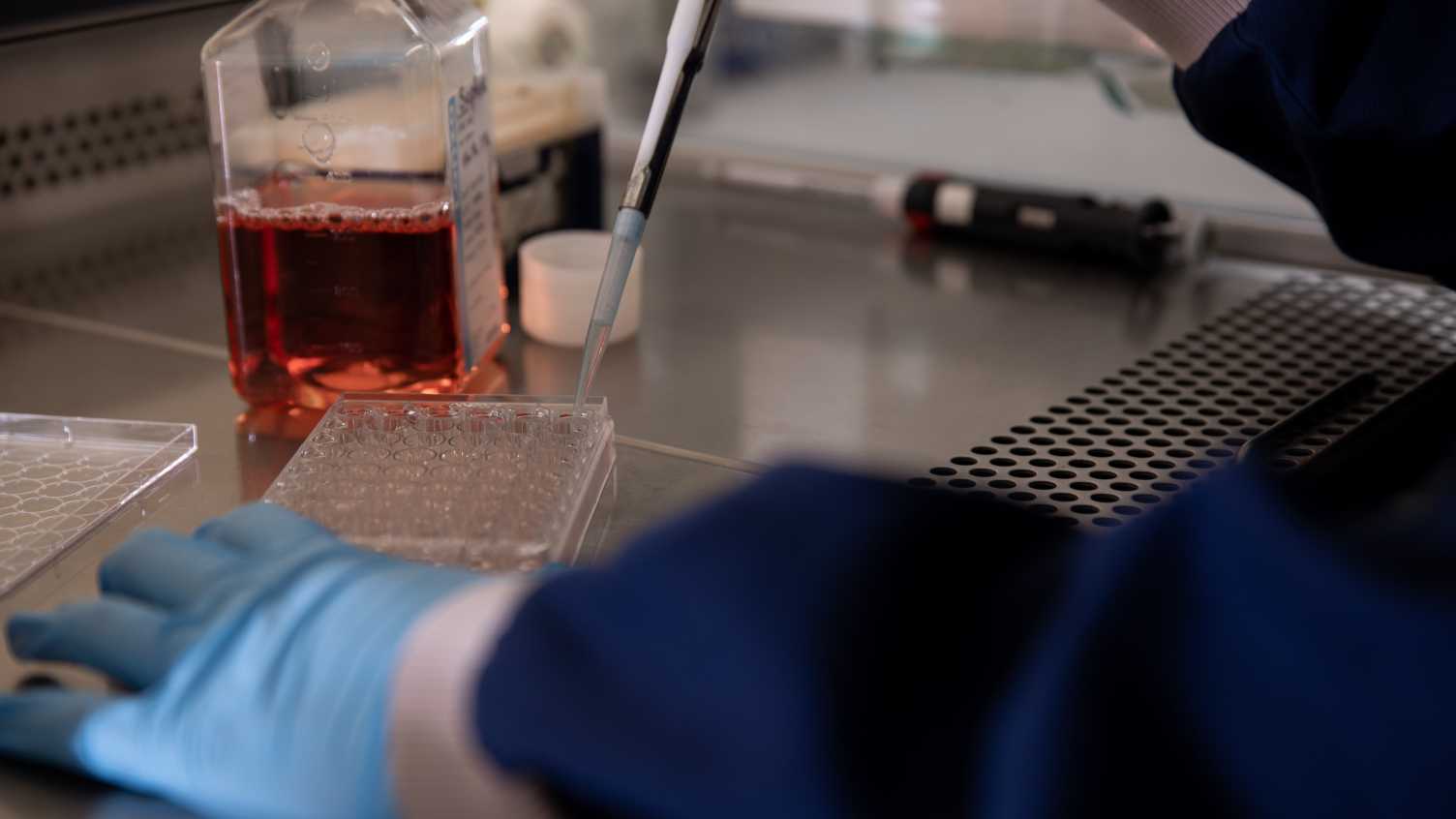 Thumbnail for Sheffield scientists win crucial grants to take forward prostate cancer research…
