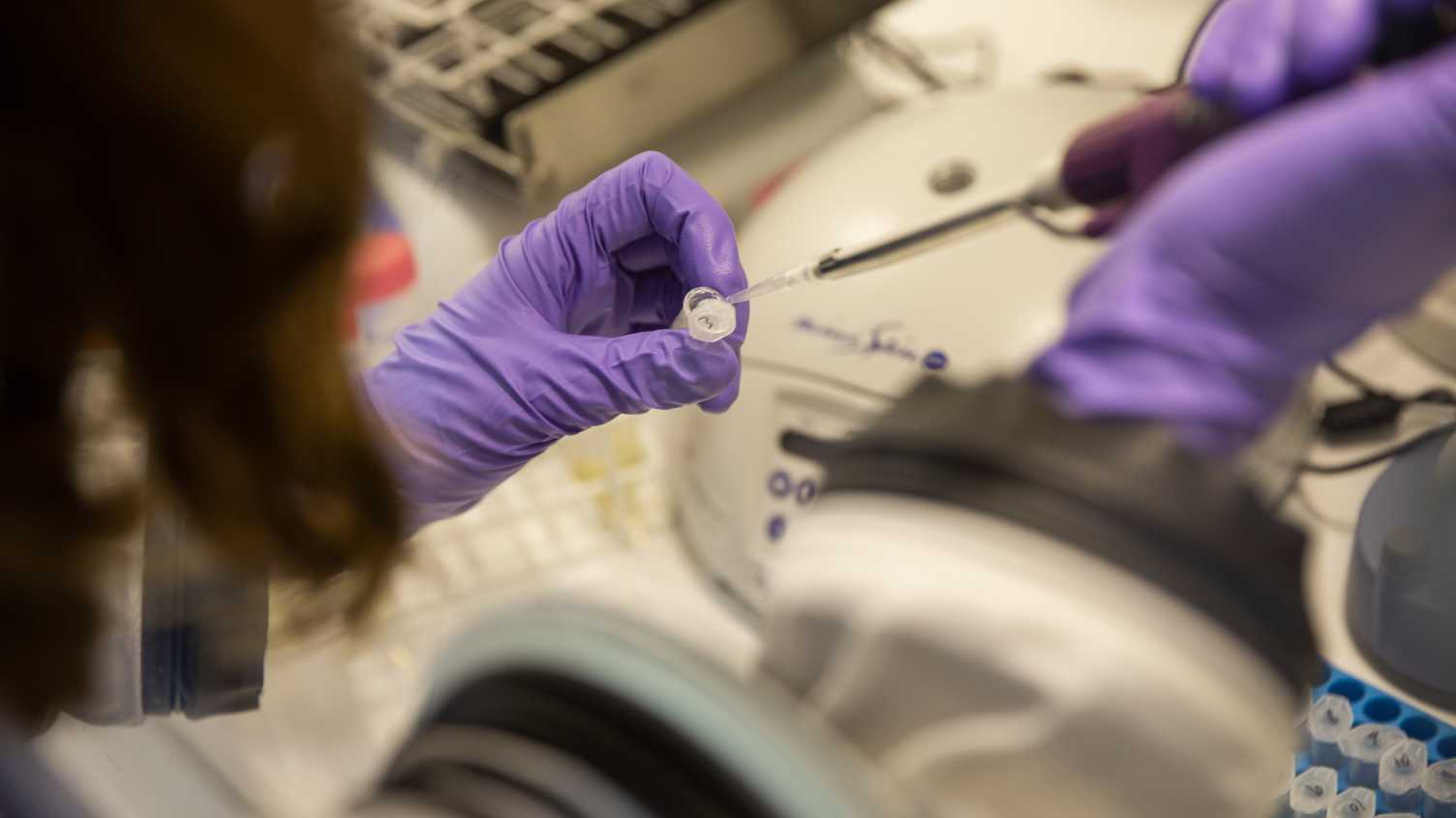 Thumbnail for Liver drug trialled in Parkinson’s patients as novel treatment approach | Medi…