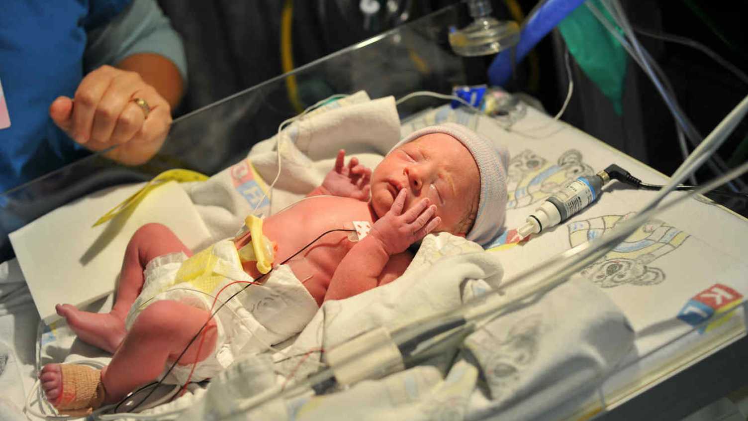 Thumbnail for £2 million grant awarded to premature birth research to reduce child deaths and…