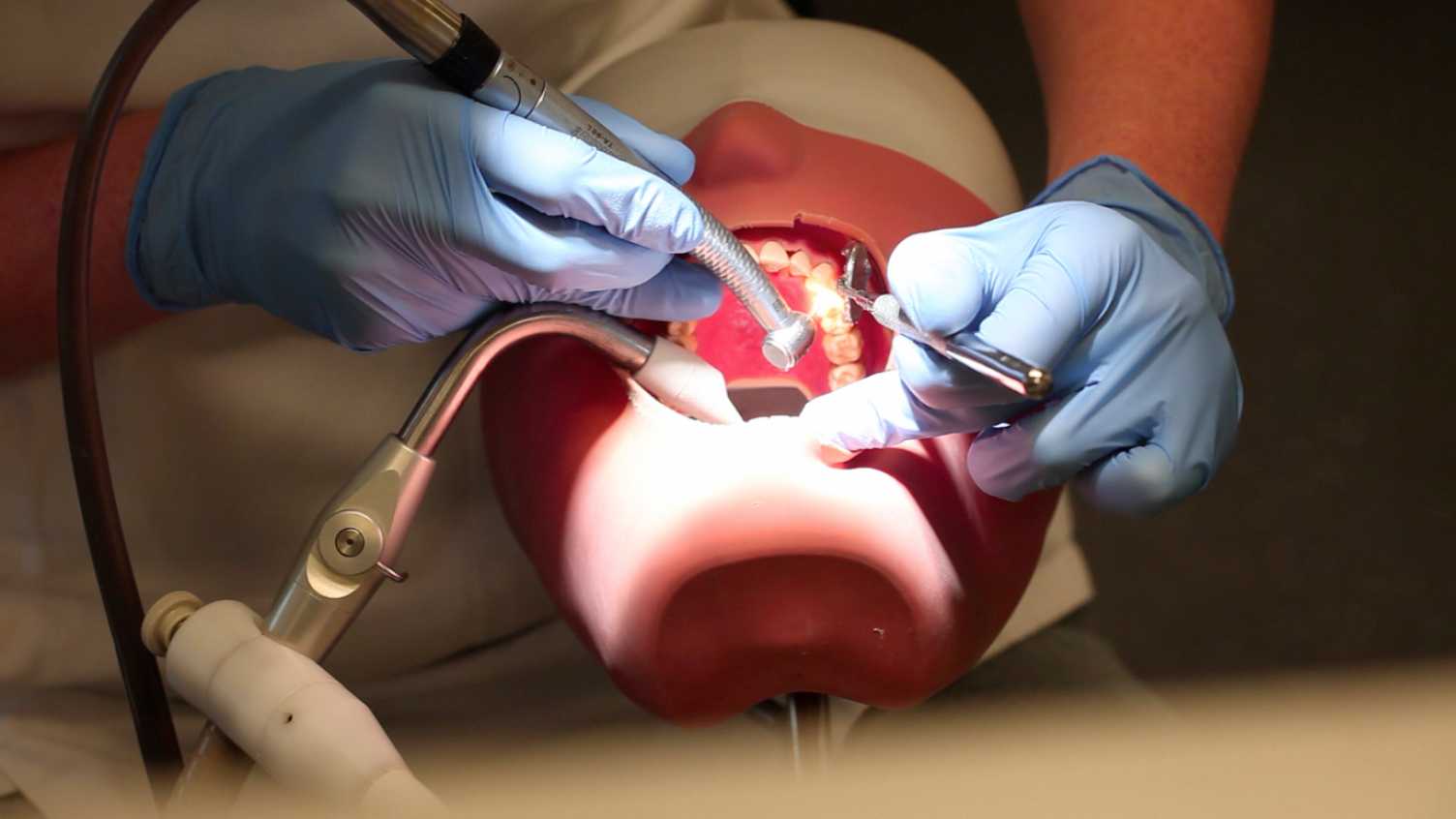 Thumbnail for String of grant successes within The School of Clinical Dentistry | Clinical Den…